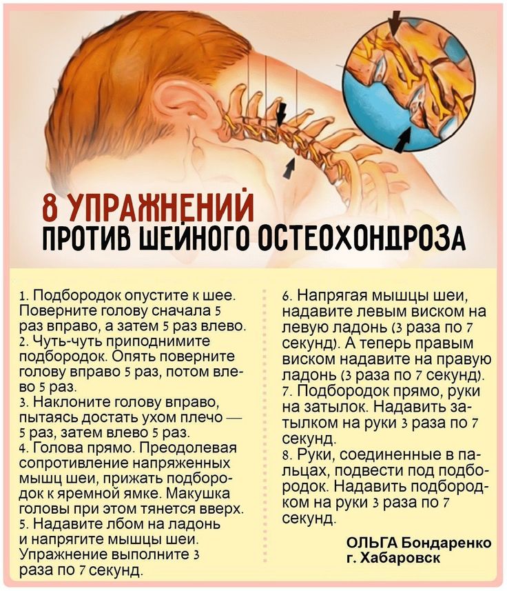 8 упражнений против шейного остеохондроза