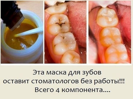 Эта маска для зубов оставит стоматологов без работы! Всего 4 компонента…
